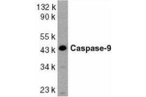 Western Blotting (WB) image for anti-Caspase 9, Apoptosis-Related Cysteine Peptidase (CASP9) (AA 299-318) antibody (ABIN2477924) (Caspase 9 antibody  (AA 299-318))