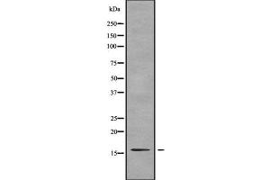 Western blot analysis of TNP2 using A549 whole cell lysates (TNP2 antibody  (Internal Region))