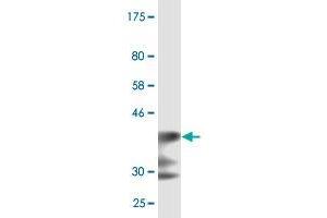 Western Blot detection against Immunogen (35. (LRP5 antibody  (AA 41-130))