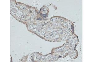 Immunohistochemistry of paraffin-embedded Human placenta using GMPR Polyclonal Antibody at dilution of 1:100 (40x lens). (GMPR antibody)