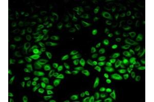 Detection of PIK3AP1 in Human Hela Cells using Polyclonal Antibody to Phosphoinositide-3-Kinase Adaptor Protein 1 (PIK3AP1) (PIK3AP1 antibody  (AA 489-730))