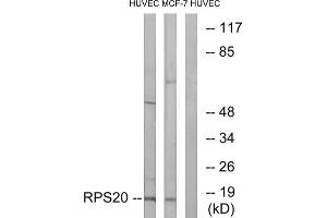 Western blot analysis of extracts from HUVEC cells and MCF-7 cells, using RPS20 antibody.