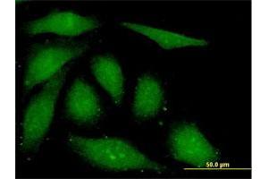 Immunofluorescence of monoclonal antibody to FGF1 on HeLa cell. (FGF1 antibody  (AA 46-155))