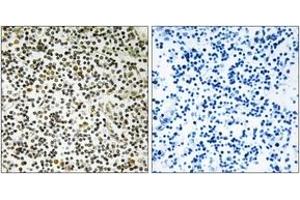 Immunohistochemistry analysis of paraffin-embedded human lymph node tissue, using CEP152 Antibody. (CEP152 antibody  (AA 841-890))