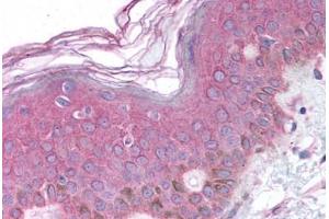 Human Skin (formalin-fixed, paraffin-embedded) stained with BARD1 antibody ABIN214634 at 10 ug/ml followed by biotinylated goat anti-rabbit IgG secondary antibody ABIN481713, alkaline phosphatase-streptavidin and chromogen. (BARD1 antibody  (AA 108-124))