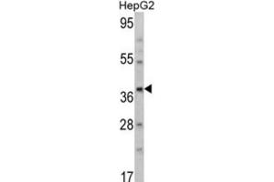 Western Blotting (WB) image for anti-Aminomethyltransferase (AMT) antibody (ABIN3002783) (Aminomethyltransferase antibody)