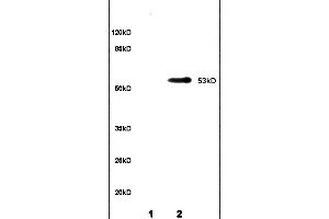 Lane 1: rat brain lysates Lane 2: rat kidney lysates probed with Anti CYP11A1 P450SCC Polyclonal Antibody, unconjugated (ABIN701530) at 1:200 in 4 °C Followed by conjugation to secondary antibody (ABIN727474-HRP) at 1:3000 90min in 37 °C Predicted band 53kD.