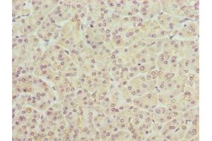 Immunohistochemistry of paraffin-embedded human pancreatic tissue using ABIN7173131 at dilution of 1:100 (TMEM25 antibody  (AA 104-153))