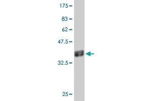 Western Blot detection against Immunogen (37. (PHF5A antibody  (AA 1-110))