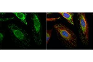 Immunofluorescence (IF) image for anti-Acetyl-CoA Acetyltransferase 1 (ACAT1) (N-Term) antibody (ABIN2855445)