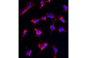 Image no. 3 for anti-Nanos Homolog 1 (NANOS1) (C-Term) antibody (ABIN356876) (Nanos Homolog 1 antibody  (C-Term))