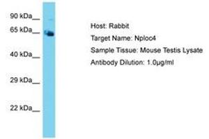 Image no. 1 for anti-Nuclear Protein Localization 4 Homolog (NPLOC4) (AA 96-145) antibody (ABIN6750475)