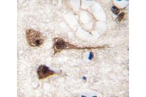IHC analysis of FFPE human brain tissue stained with MEF2C antibody (MEF2C antibody  (AA 278-307))