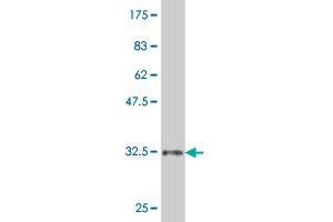 Western Blot detection against Immunogen (34. (ZIC1 antibody  (AA 139-212))