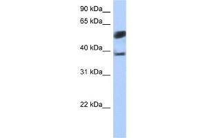 WB Suggested Anti-SPOPL Antibody Titration:  0. (SPOPL antibody  (N-Term))