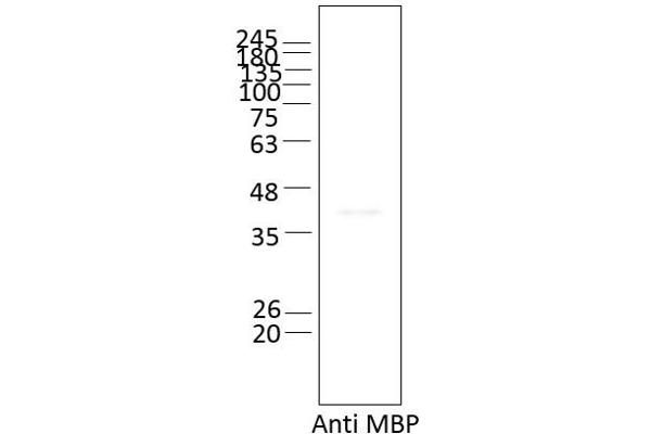 Ataxin 2 Protein (ATXN2) (AA 1-1313)