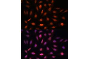 Immunofluorescence analysis of U-2 OS cells using PPIL4 antibody (ABIN7269212) at dilution of 1:100. (PPIL4 antibody  (AA 301-492))