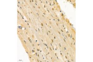 Immunohistochemistry of paraffin embedded rat heart using ZNF106 (ABIN7076260) at dilution of 1:300 (400x lens) (ZFP106 antibody)
