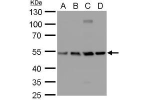 WB Image beta Tubulin 2 antibody detects beta Tubulin 2 protein by western blot analysis. (TUBB2A antibody)