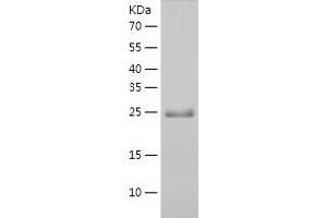 Western Blotting (WB) image for Chloride Intracellular Channel 3 (CLIC3) (AA 1-236) protein (His tag) (ABIN7122353) (CLIC3 Protein (AA 1-236) (His tag))