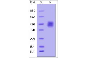 Biotinylated Human IL-4 R alpha / CD124, His Tag on SDS-PAGE under reducing (R) condition. (IL4 Receptor Protein (AA 26-232) (His tag,AVI tag,Biotin))