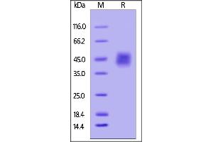 Biotinylated Human IL-4 R alpha / CD124, His Tag on SDS-PAGE under reducing (R) condition.