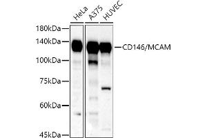 Western blot analysis of extracts of various cell lines, using CD146/MCAM antibody (ABIN6127568, ABIN6143621, ABIN6143622 and ABIN6218100) at 1:500 dilution. (MCAM antibody  (AA 447-646))