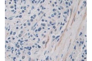 Immunohistochemistry (IHC) image for anti-Inter-alpha Trypsin Inhibitor, Heavy Chain 1 (ITIH1) (AA 507-819) antibody (ABIN7436564)