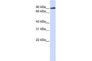 WB Suggested Anti-DCLRE1C Antibody Titration:  0. (DCLRE1C antibody  (N-Term))