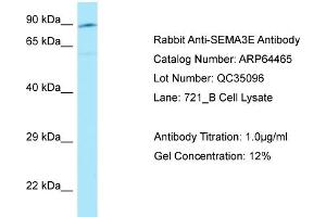 Western Blotting (WB) image for anti-Sema Domain, Immunoglobulin Domain (Ig), Short Basic Domain, Secreted, (Semaphorin) 3E (SEMA3E) (C-Term) antibody (ABIN2789847) (SEMA3E antibody  (C-Term))