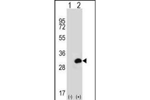Western blot analysis of CA1 (arrow) using rabbit polyclonal CA1 Antibody (N-term) (ABIN656574 and ABIN2845835). (CA1 antibody  (N-Term))
