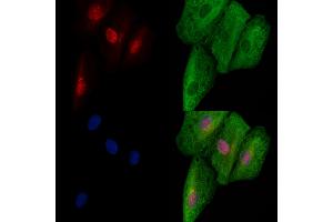 ABIN6257152 and ABIN6273721 staining  cells by IF/ICC. (E2F8 antibody  (C-Term))