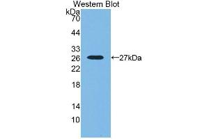 Western blot analysis of the recombinant protein. (SNX18 antibody  (AA 411-614))