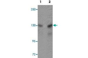 Western blot analysis of A-20 cells with MTUS2 polyclonal antibody  at (Lane 1) 0. (CAZIP antibody  (C-Term))