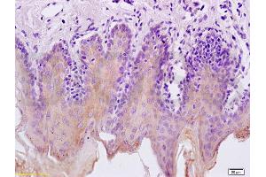 Formalin-fixed and paraffin embedded rat tongue labeled with Rabbit Anti Cytokeratin 5/CK5 Polyclonal Antibody, Unconjugated (ABIN737061) at 1:200 followed by conjugation to the secondary antibody and DAB staining (Cytokeratin 5 antibody  (AA 331-430))