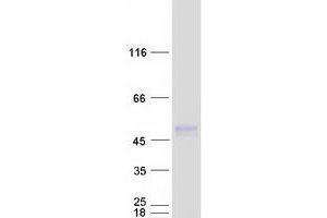 Western Blotting (WB) image for Transmembrane Protein 51 (TMEM51) (Transcript Variant 4) protein (Myc-DYKDDDDK Tag) (ABIN2733901)