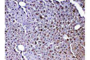 IHC analysis of PARK7 / DJ1 using anti-PARK7 / DJ1 antibody . (PARK7/DJ1 antibody  (AA 2-189))
