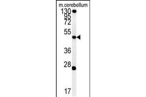 Western blot analysis of ENPP6 Antibody in mouse cerebellum tissue lysates (35ug/lane) (ENPP6 antibody  (AA 170-197))