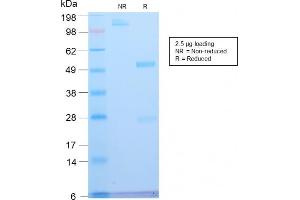 SDS-PAGE Analysis Purified ATRX Rabbit Recombinant Monoclonal Antibody (ATRX/2900R). (Recombinant ATRX antibody)