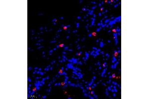 Immunofluorescence of paraffin embedded human stomach using GLP1 (ABIN7074053) at dilution of 1:500 (400x lens) (GLP-1 antibody)