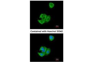ICC/IF Image Immunofluorescence analysis of methanol-fixed A549, using AGR3, antibody at 1:200 dilution. (AGR3 antibody  (Center))