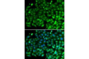 Immunofluorescence analysis of A549 cells using SH3GLB1 antibody (ABIN5974271). (SH3GLB1 antibody)