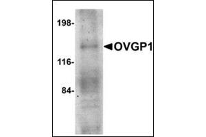 Western blot analysis of OVGP1 in human placenta tissue lysate with this product at 1 μg/ml.