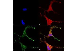 Immunocytochemistry/Immunofluorescence analysis using Mouse Anti-Cav beta 2 Monoclonal Antibody, Clone S8B-1 (ABIN2485039). (CACNB2 antibody  (AA 189-205) (FITC))