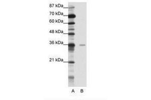 Image no. 1 for anti-Methyl-CpG Binding Domain Protein 2 (MBD2) (AA 151-200) antibody (ABIN202197) (MBD2 antibody  (AA 151-200))