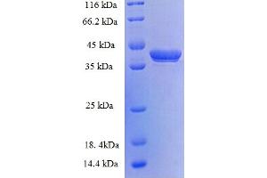 SDS-PAGE (SDS) image for G Antigen 5 (GAGE5) (AA 1-117), (full length) protein (GST tag) (ABIN5709551)