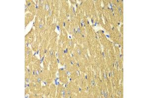 Immunohistochemistry (IHC) image for anti-Tropomyosin 3 (TPM3) (AA 1-284) antibody (ABIN6215629) (TPM3 antibody  (AA 1-284))