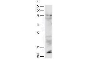 Lane 1: mouse lung probed with Rabbit Anti-Sclerostin Polyclonal Antibody, Unconjugated  at 1:5000 for 90 min at 37˚C. (Sclerostin antibody  (AA 121-180))