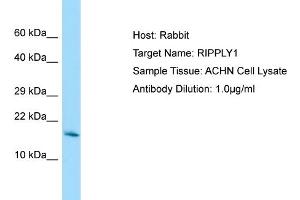 Host: Rabbit Target Name: RIPPLY1 Sample Tissue: Human ACHN Whole Cell Antibody Dilution: 1ug/ml (RIPPLY1 antibody  (Middle Region))