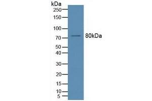 Detection of ASM in Mouse Brain Tissue using Polyclonal Antibody to Acid Sphingomyelinase (ASM) (SMPD1 antibody  (AA 319-579))